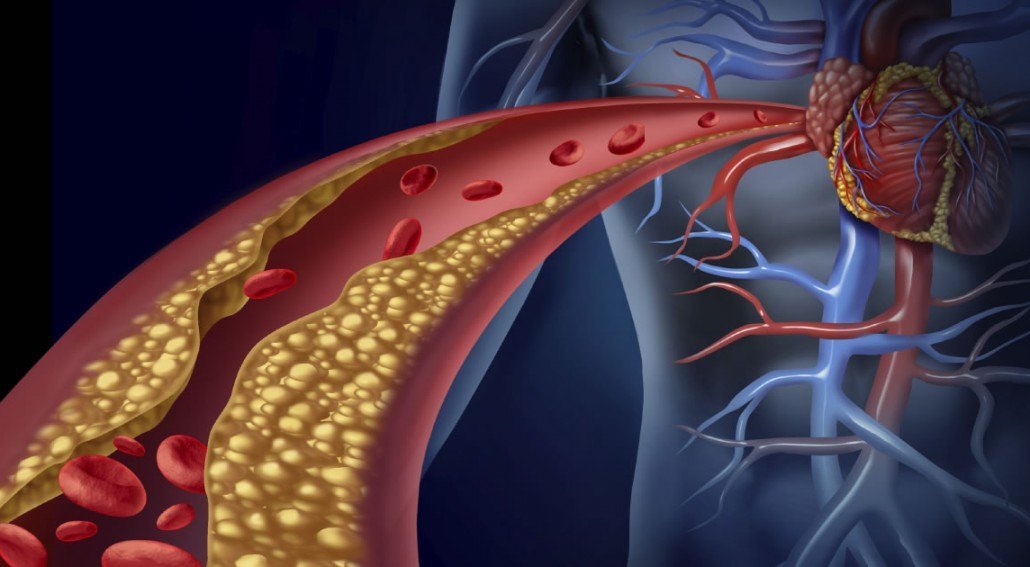 Linus Pauling on What Causes Hardening Of The Arteries: The Collagen and Vitamin C Connection