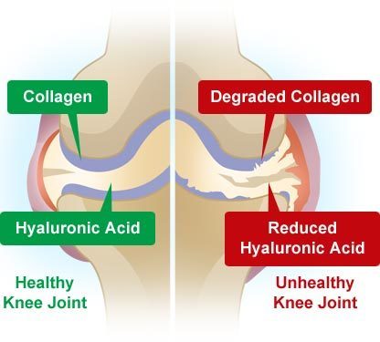 Image result for collagen and joints